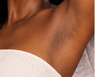 Underarm treatment